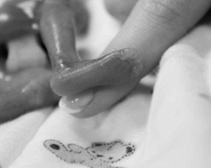 Image of a premature baby's foot being held up against a fingernail for size comparison